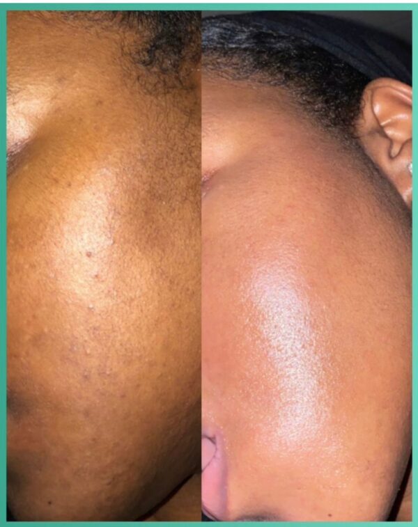 Turmeric cleansing pads product packaging